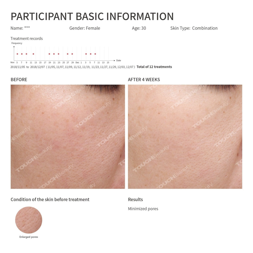Hot & Cool Skin Device – Advanced Facial & Eye Rejuvenation