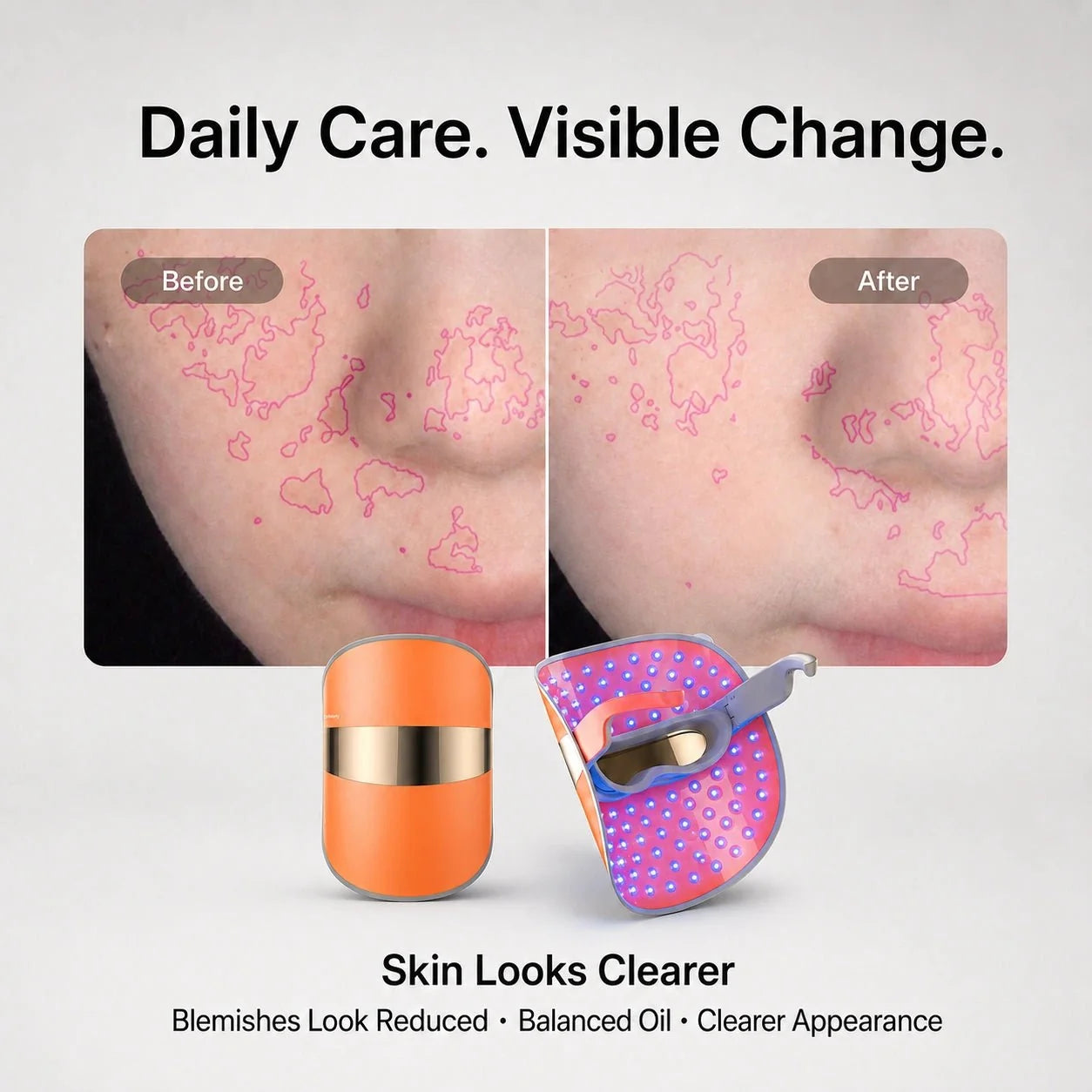 GLAM LED Light Therapy Mask for Clearer, Brighter Skin